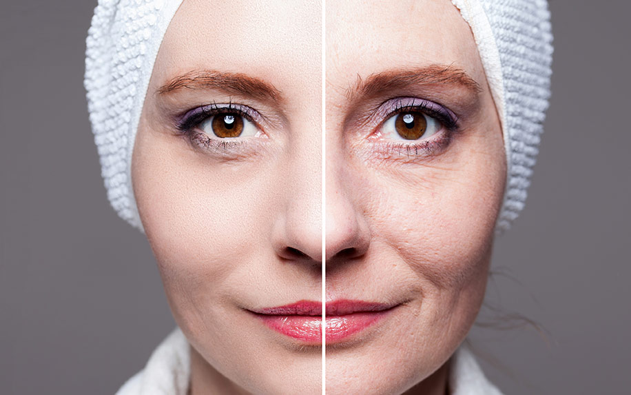 how CBD Oil Helps In Reducing Wrinkles And Looking Younger