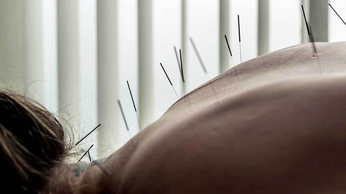 3728-acupuncture_female_1296x728-header
