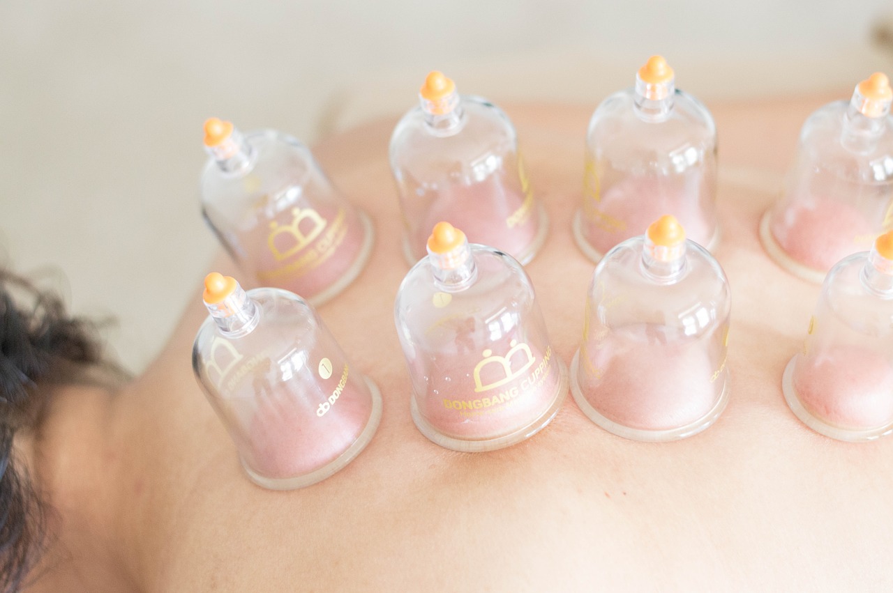 Cupping Treatment-9e7617ba