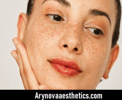 5 Best Acne Facial Treatments For Acne Prone Oily Skin