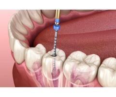 Root Canal Treatment in Robstown | Robstown Smiles