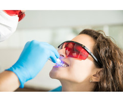 Illuminate Your Smile by Expert Teeth Whitening in Essendon