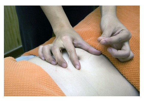 Harmony and Health: Chinese Acupuncture at OTCM, Milton, ON