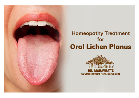 Homeopathic Treatment of Oral Lichen Planus at CHHC