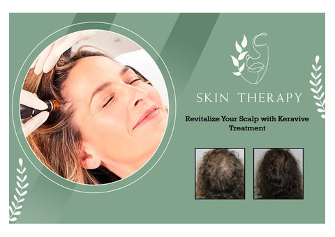 Keravive Scalp Treatment In Portsmouth-Skintherapyportsmouth