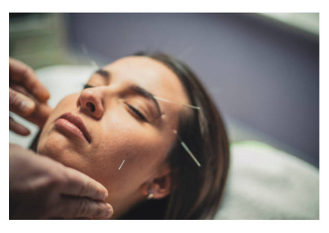 Find the Top Acupuncture Treatment Options in London