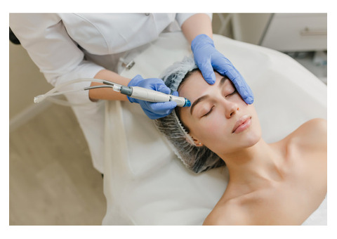 Microneedling Radiofrequency for Erasing Acne Scars