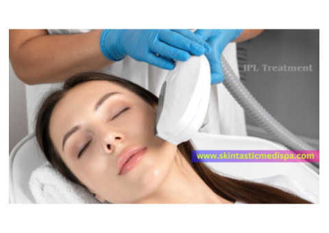 IPL Treatment for Revitalize Your Skin