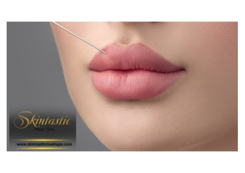 Redefine Your Smile with Lip Fillers Treatment