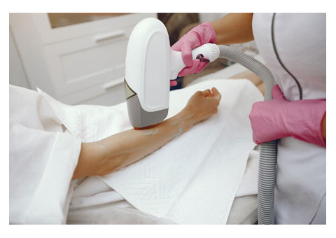 laser hair removal in Hyderabad
