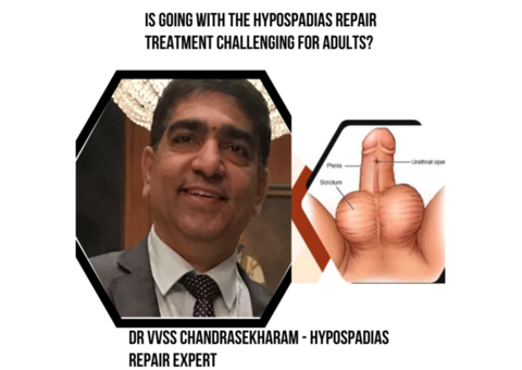 Going With the Hypospadias Repair Treatment Challenging for Adults