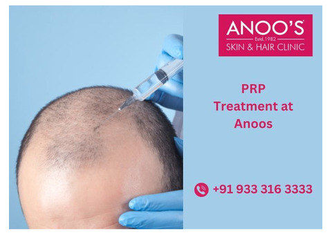 Advanced PRP Treatment for Hair Regrowth at Anoos