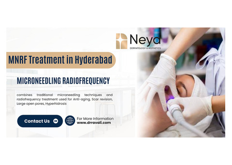 MNRF Treatment in Hyderabad