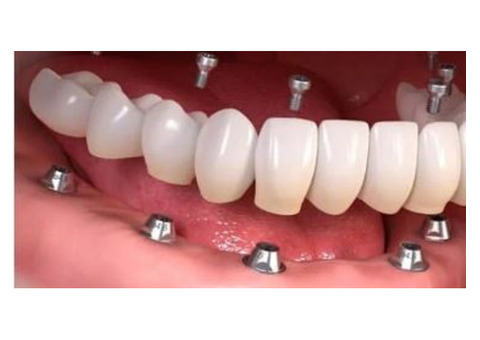 Summerlin Dental Care offers advanced laser dentistry
