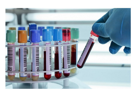 Top Biobanking  Services In Hyderabad
