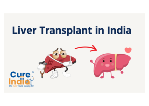 Трансплантация печени в Индии: Почему CureIndia выделяется