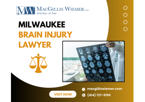 Can a Milwaukee brain injury lawyer help you win your case?