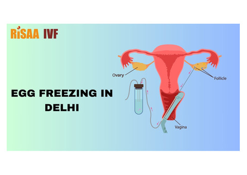 Egg Freezing in Delhi - Preserve Your Future Fertility with Risaa IVF
