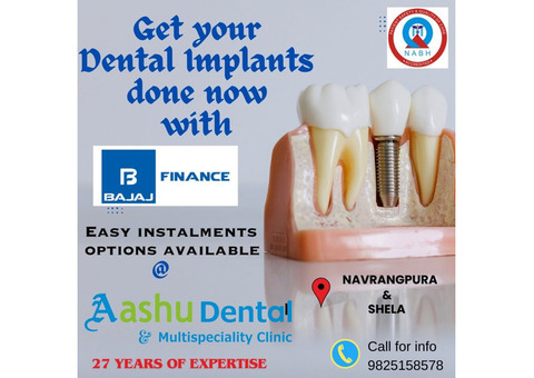 Dentist in Ahmedabad Book Appointment Online | 9825158578