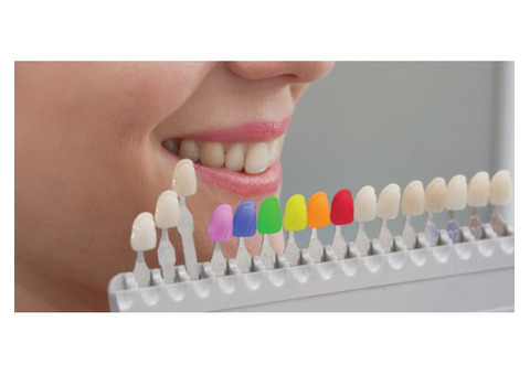 Tooth Colored Fillings Perris | Dental Fillings in California | Nuevo