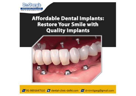 Affordable Dental Implants: Restore Your Smile with Quality Implants