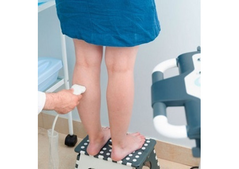 Phlebectomy Treatment Perth Effective Vein Removal Procedures