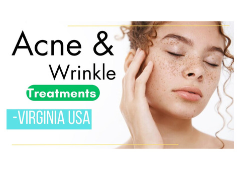 A Guide to Main Acne Treatments Warrenton VA