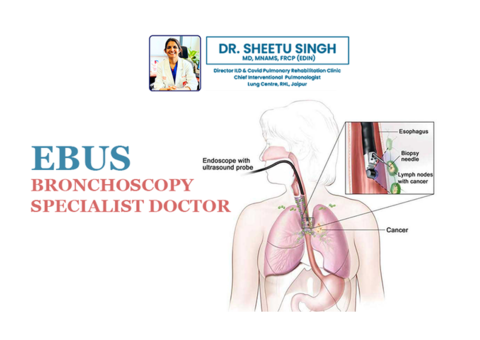 Expert Bronchoscopy Specialist Doctor in Kota - Dr. Sheetu Singh