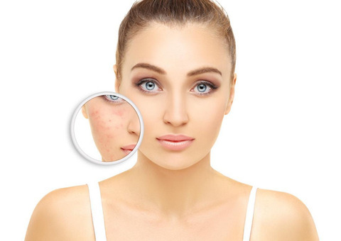 Discover Wrinkle Reduction Laser Treatments at Our Skin Clinic!