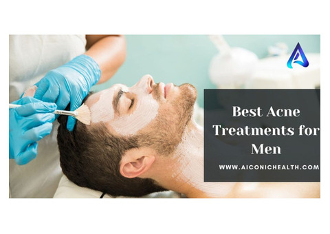 Best Acne Treatments for Men