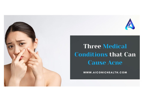 Three medical conditions that can cause acne