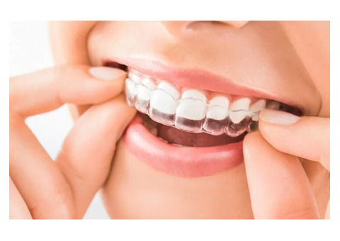 Find the Best Invisible Braces for a Perfectly Aligned Smile