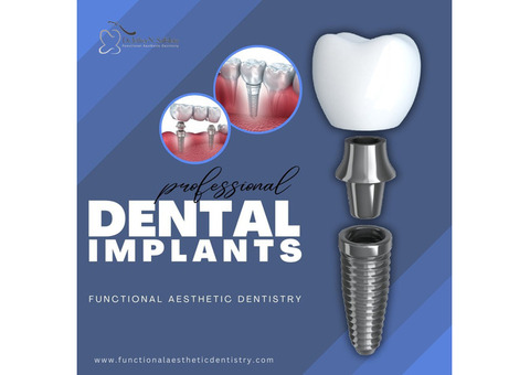 Dental implants Summerlin