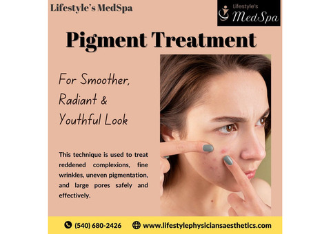 Revitalize Your Skin with Pigment Treatment in Warrenton, VA