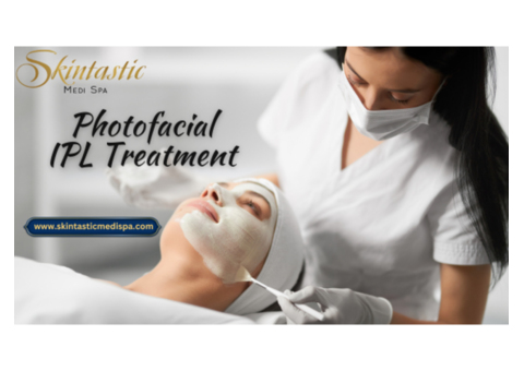 Natural Glow with Photofacial IPL in Riverside