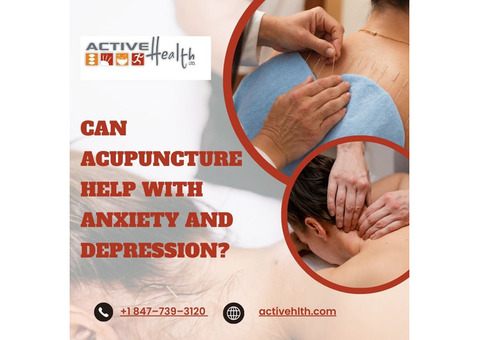 How to Find the Right Acupuncturist for Your Needs