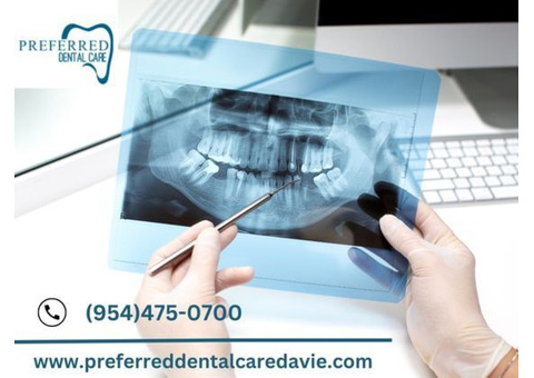 Professional Dental X-Ray Clinic in Davie – Preferred Dental Care