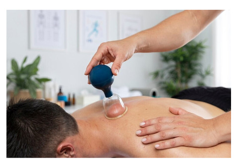 Local Cupping Therapist Las Vegas