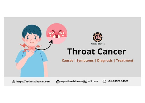 Throat Cancer Treatment in Jaipur - Asthma Bhawan