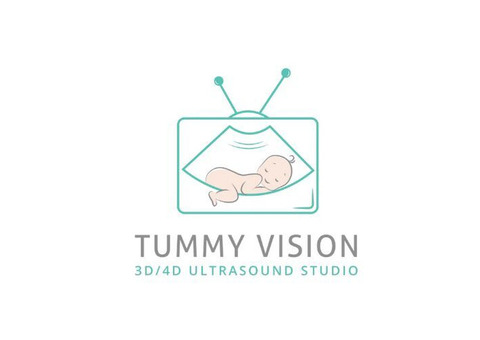 20 week 3d ultrasound by Tummy Vision