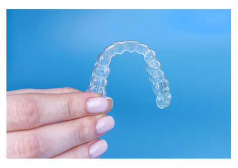 Top Benefits of Clear Aligners