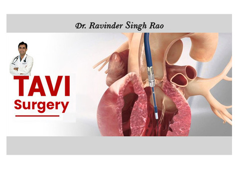 Top Cardiologist for TAVI Surgery in India