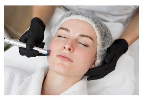 Laser Skin Resurfacing Treatments in Kingston and New Paltz