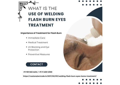 What is the Use of Welding Flash Burn Eyes Treatment