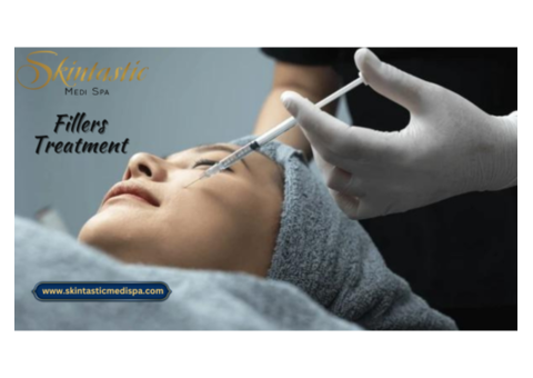 FDA Approved Fillers in Riverside