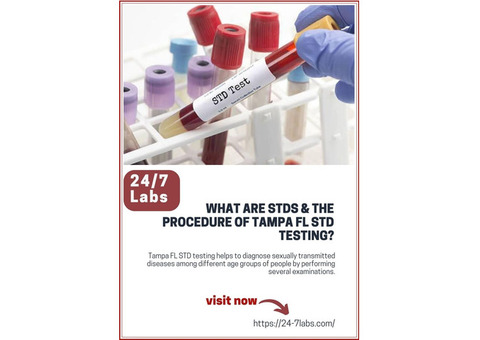 What are STDs & The Procedure of Tampa FL STD Testing?