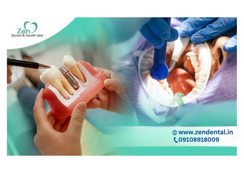 Best Root Canal Dentist in Sarjapur Road Bangalore – Zen Dental Care