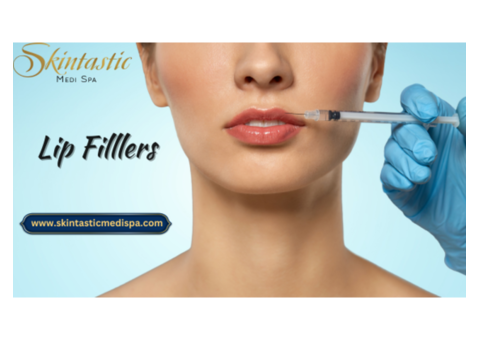 Lip Fillers in Riverside for Smooth Lips