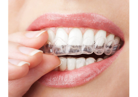 Get Invisible Braces In Mumbai for Superior Results