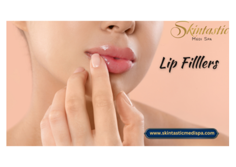 Top-Quality Lip Fillers in Riverside for Perfect Lips